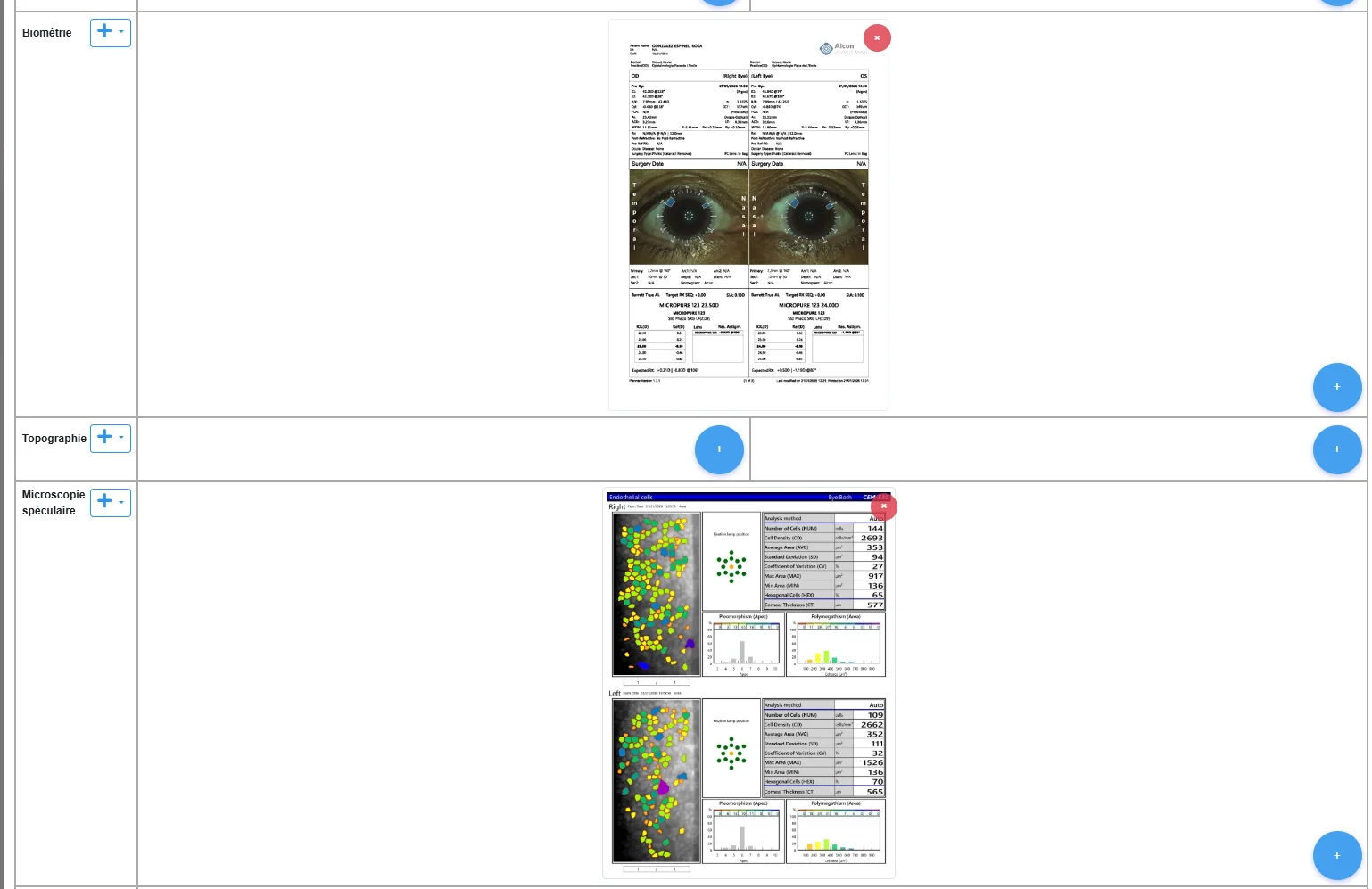 Specialized exams biometry topography microscopy